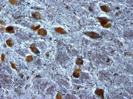 Photo of brain tissue